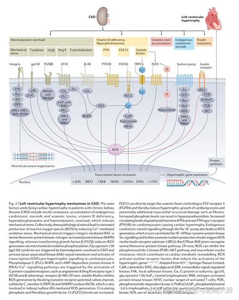慢性肾脏病：心脏随之发生的变化（二） 知乎