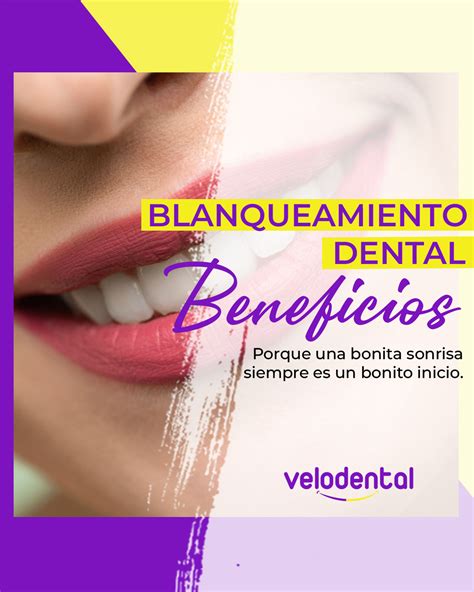 Principales Beneficios Del Blanqueamiento Dental Velodental