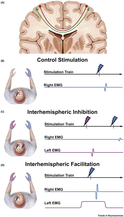 The Cortical Physiology Of Ipsilateral Limb Movements Trends In