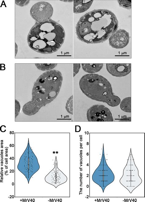 Morphology Of Vacuoles In Virus Infected And Virus Cured Malassezia