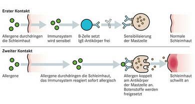 Lebensmittelallergien Apotheken Umschau