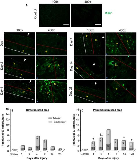 Cell Proliferation Positive Ki Immunofluorescence Staining In The