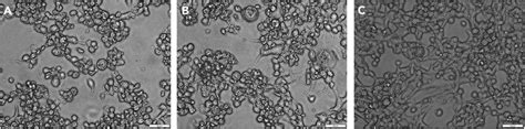 Cytopathic Effect Of Rcvsvs In Bhk Wi Cells H Post Inoculation