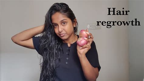 Hair Regrowth Hair Fall Solution Hair Care Sowmya Nanda Youtube