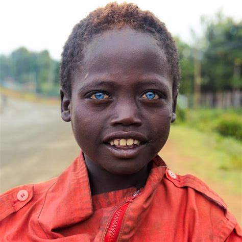 Voici Pourquoi Certains Africains Noirs Ont Les Yeux Bleus