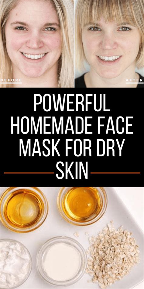 3 Powerful Homemade Face Mask For Dry Skin Skin Care Tips In 2020