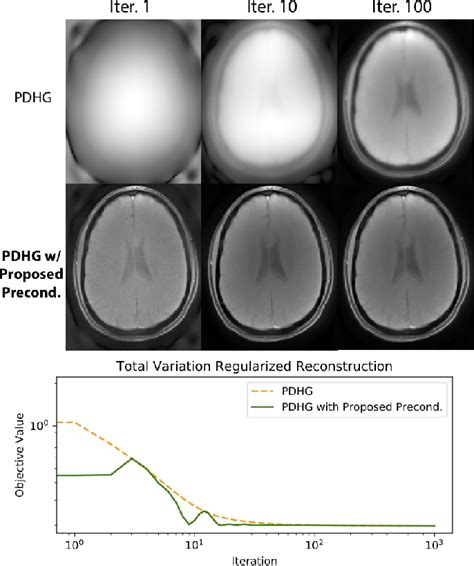 Figure From Accelerating Non Cartesian Mri Reconstruction Convergence