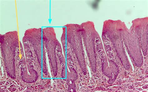 The Senses Histology of the Tongue Flashcards | Quizlet