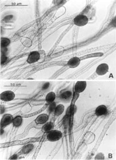 A B Allomyces Neomoniliformis A Detalle Del Micelio Reticulado Y