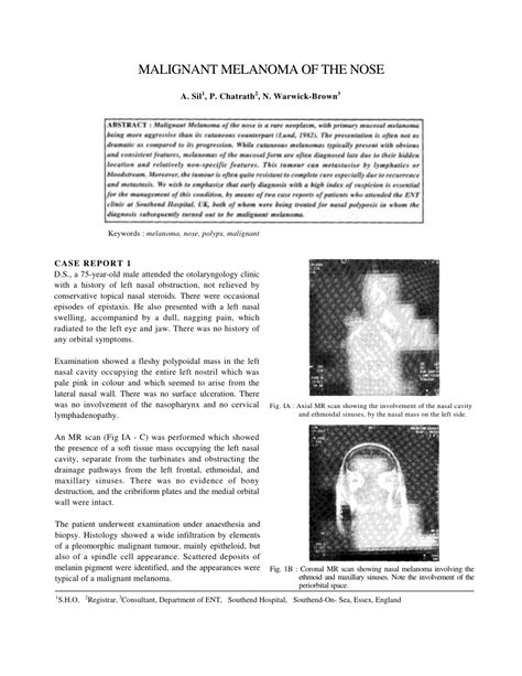 (PDF) Malignant melanoma of the nose