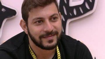 Ex BBB Caio Afiune Faz Transplante Capilar E Comemora Adeus Careca