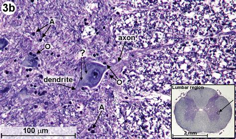 Motor Neuron Slide Labeled Glial Cells