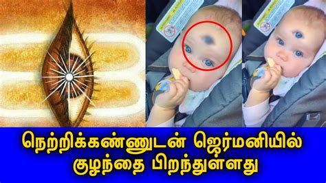 Baby Born With 3 Eye German Baby Born With 3 Eyes Britian Tamil