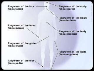 Dermatophyte Infection: What Is It, Causes, Signs And, 60% OFF