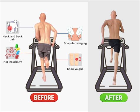 Incredible Scoliosis Results Functional Patterns Brisbane