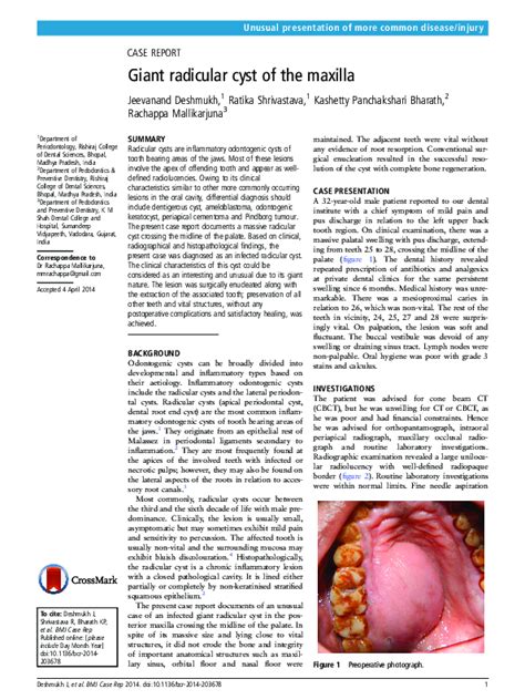 Pdf Giant Radicular Cyst Of The Maxilla Ratika Shrivastava