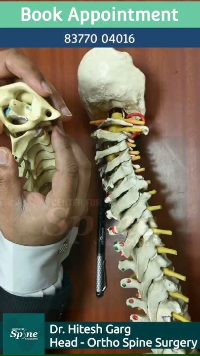 What Is C1 C2 Instability Instability Cervical Spine Surgeon In India