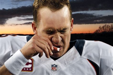 What S Up With Peyton Manning S Forehead