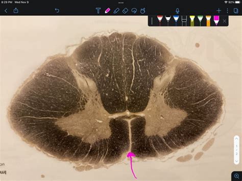 Spinal Cord And Medulla Tracts Flashcards Quizlet