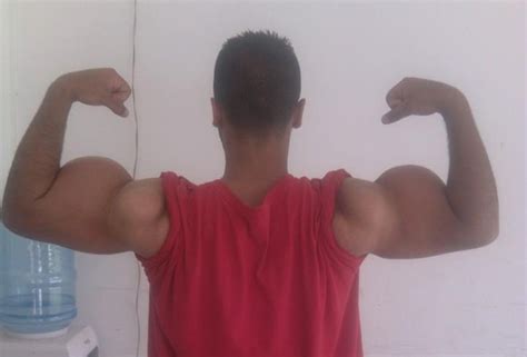 Body Synthol