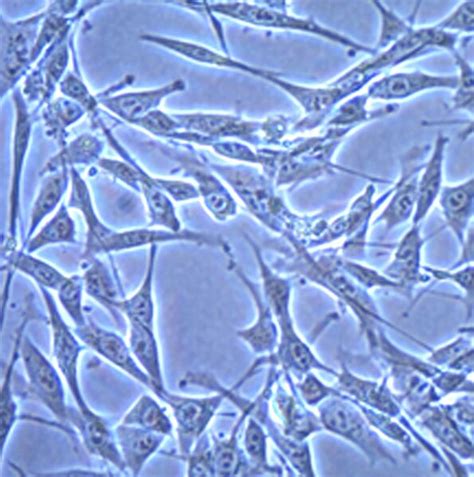 Sma Mouse Orthotopic Glioma Cell Line Scc