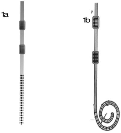 Peritoneal Dialysis Catheter Types