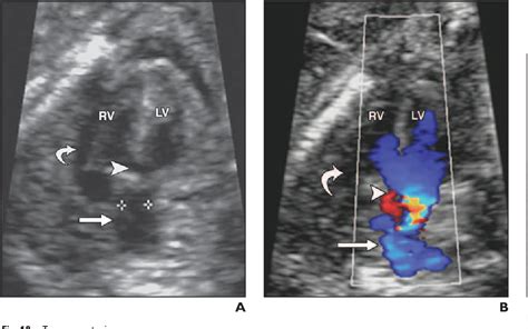 Fetal Anomalies Ultrasound