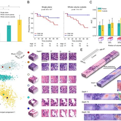 Mamba Analysis Of Open Top Light Sheet Microscopy Otls Prostate