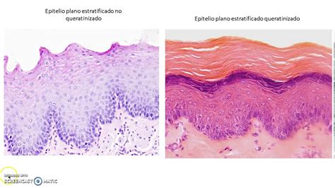 Waidelich Fabio Epitelio Plano Estratificado YouTube