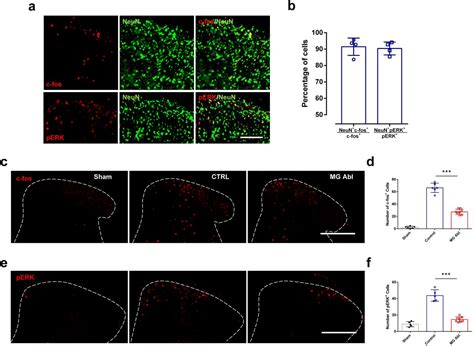 Spinal Microglia Contribute To Sustained Inflammatory Pain Via