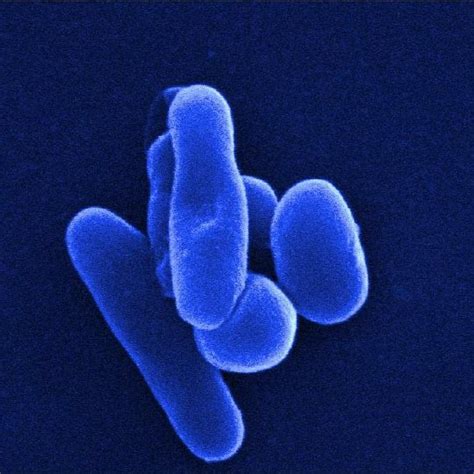 (PDF) Morphological Characterization of Mycobacterium tuberculosis