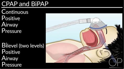 How To Navigate Cpap And Bipap At Home By L Perlman B Walsh Openpediatrics Youtube