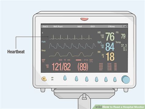 3 Ways to Read a Hospital Monitor - wikiHow