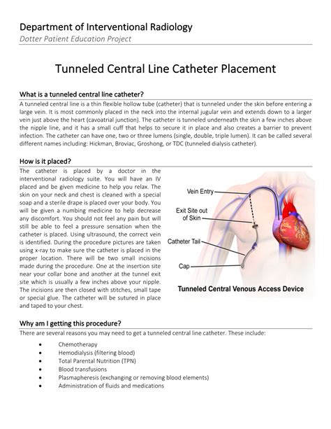 Tunneled Central Line Catheter Placement - DocsLib