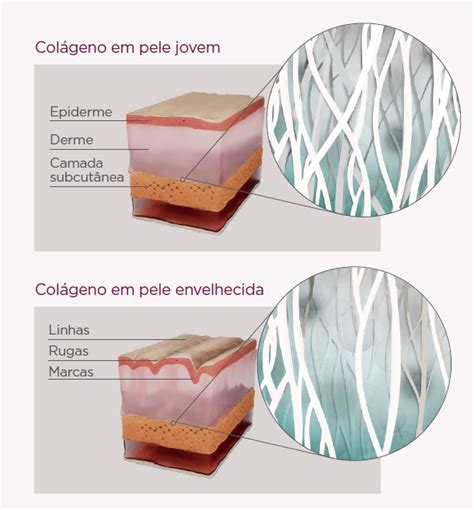 Como Repor O Col Geno Perdido Na Pele O Seu Portal De Beleza Na Web