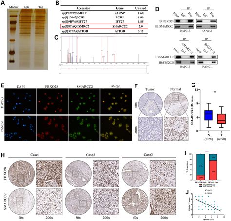 FBXO28 Promotes Proliferation Invasion And Metastasis Of Pancreatic