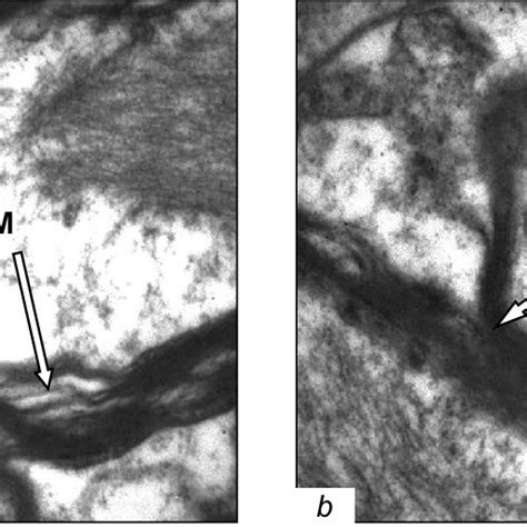 Ultrastructure Of The Medulla Oblongata In Ep ×16000 A Without