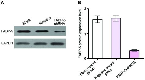 Effect Of Fabp Gene Silencing On The Proliferation Apoptosis And