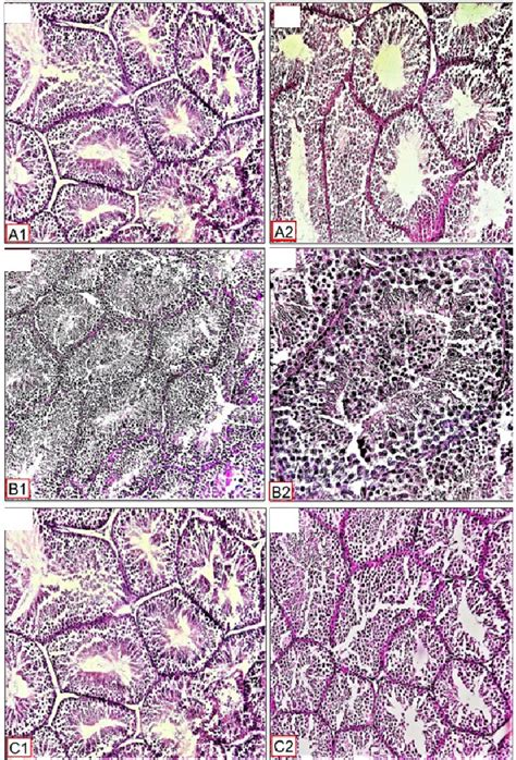 Histological Photomicrograph Structure Of Testis Of Testis Of Tt50