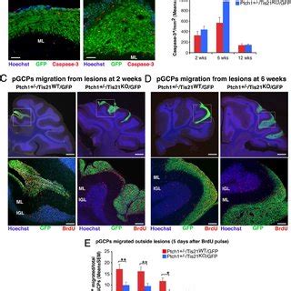 Ablation Of Tis In Patched Heterozygous Or Wild Type Mice Does Not