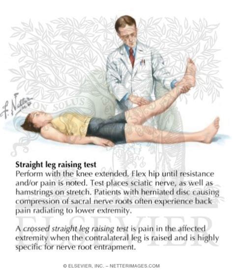 Straight Leg Raise Test