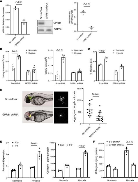 Jci Insight Hypoxia Enhances Ipf Mesenchymal Progenitor Cell