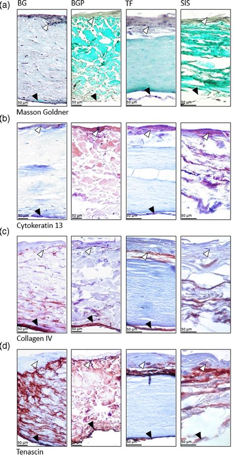 Characterization Of Tissue Engineered Oral Mucosa Equivalents Teoms