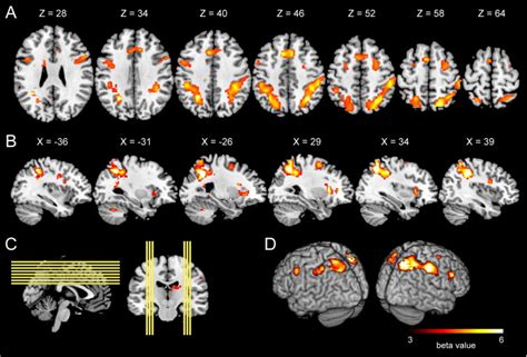 Neural Correlates Underlying The Precision Of Visual Working Memory