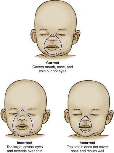 Pediatric Emergencies And Resuscitation Obgyn Key