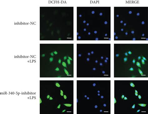 The Effect Of Mir P Knockdown On Oxidative Stress Injury In The