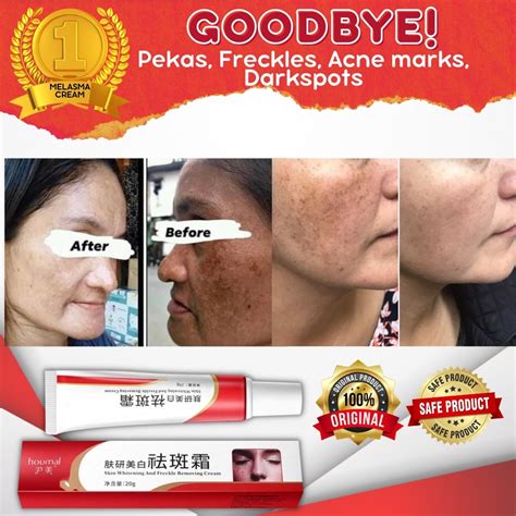 Pekas Remover Effective Melasma Cream Anti Freckle Collagen Original