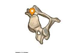 Uncinate process of vertebra - e-Anatomy - IMAIOS