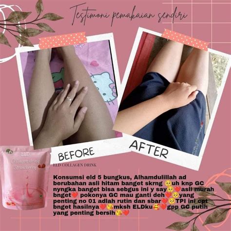 Jual Eld Collagen Drink Strawberry Shopee Indonesia