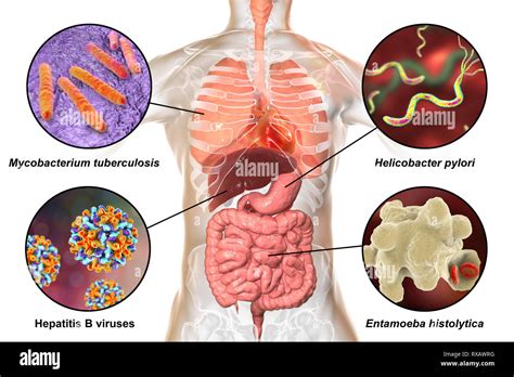 Las bacterias que causan infecciones en humanos ilustración Fotografía